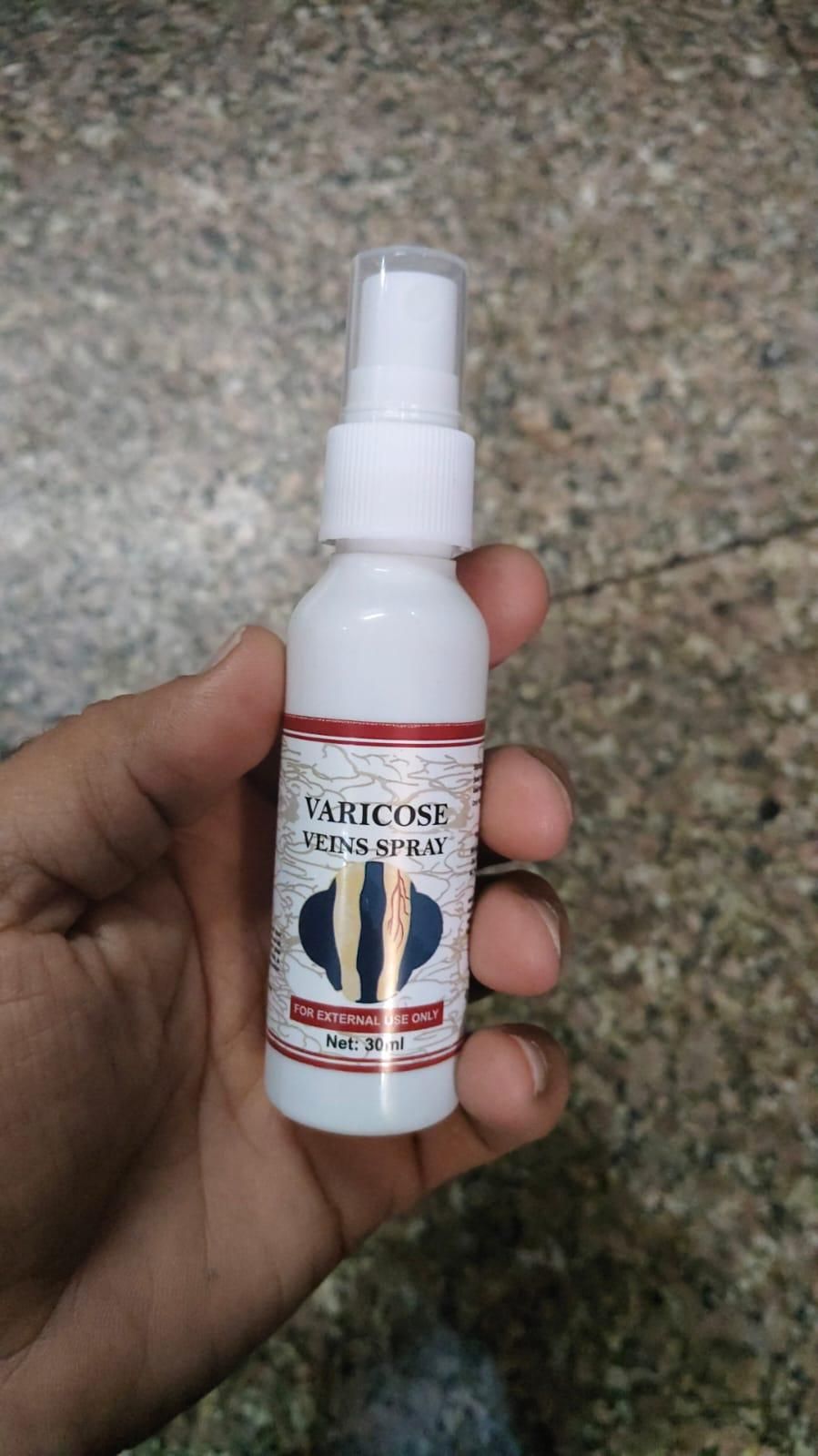 Vein Healing Varicose Veins Treatment Spray – Pack of 2  Description: